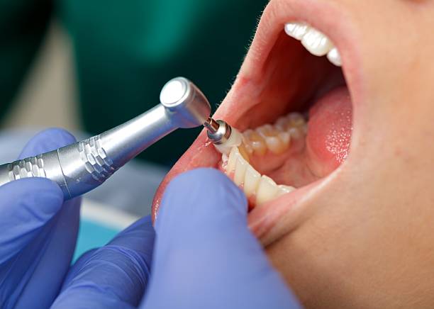 Laser Dentistry in Portola Valley, CA